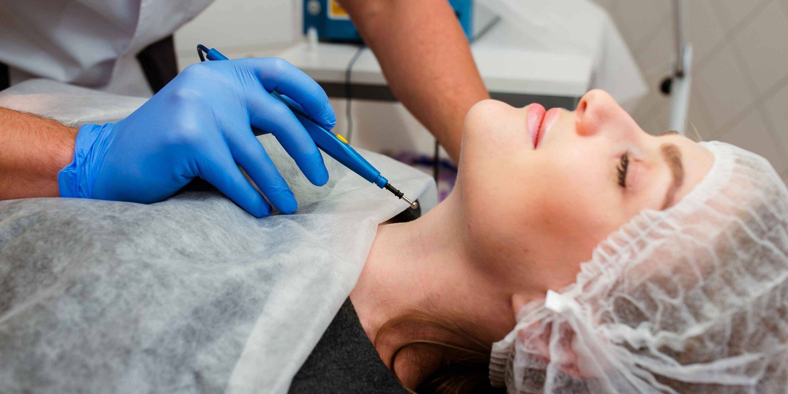 Tratamento Cirúrgico do Nevo Melanocítico Gigante: Abordagem Atual e Considerações Clínicas