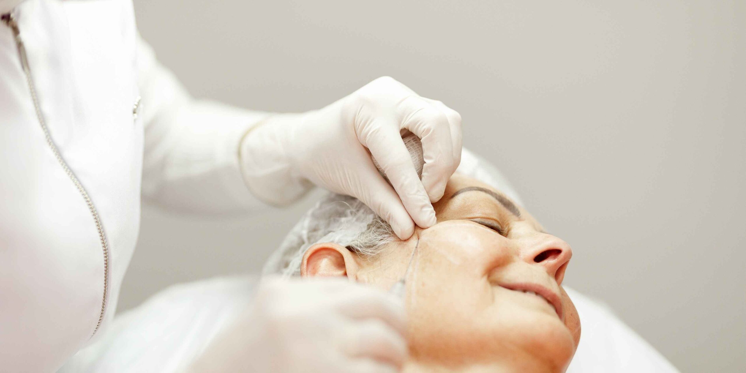 Radiesse® em Foco: síntese crítica do artigo “Use of calcium hydroxylapatite (Radiesse®) for facial augmentation” (Jacovella, 2008)