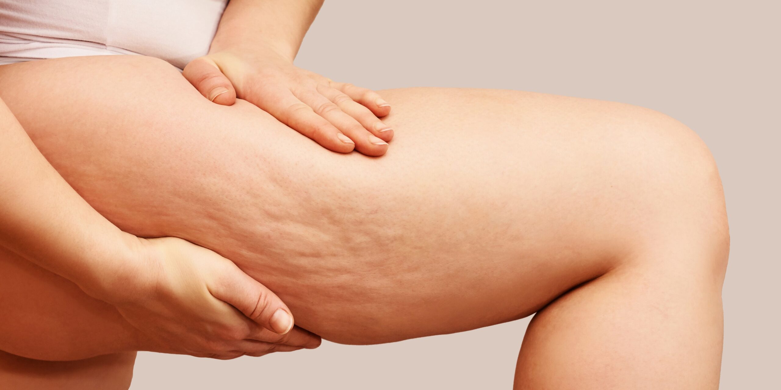 Exossomos Na Dermatologia O Essencial Do Artigo Guia Brasileiro De 